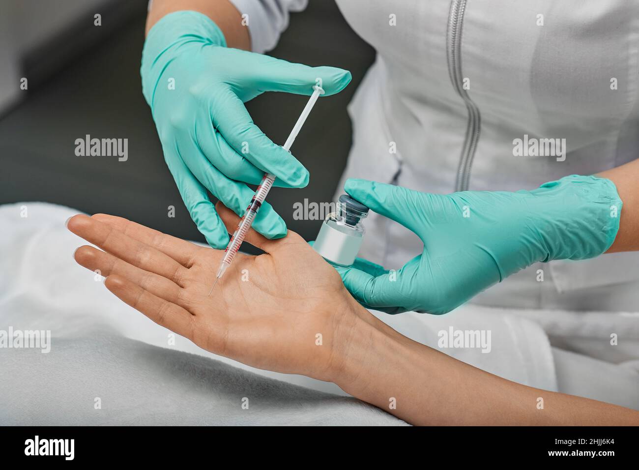 Traitement de l'hyperhidrose palmar.Main de la femme pendant l'injection de toxine botulinique dans la paume pour traiter l'hyperhidrose de paume Banque D'Images