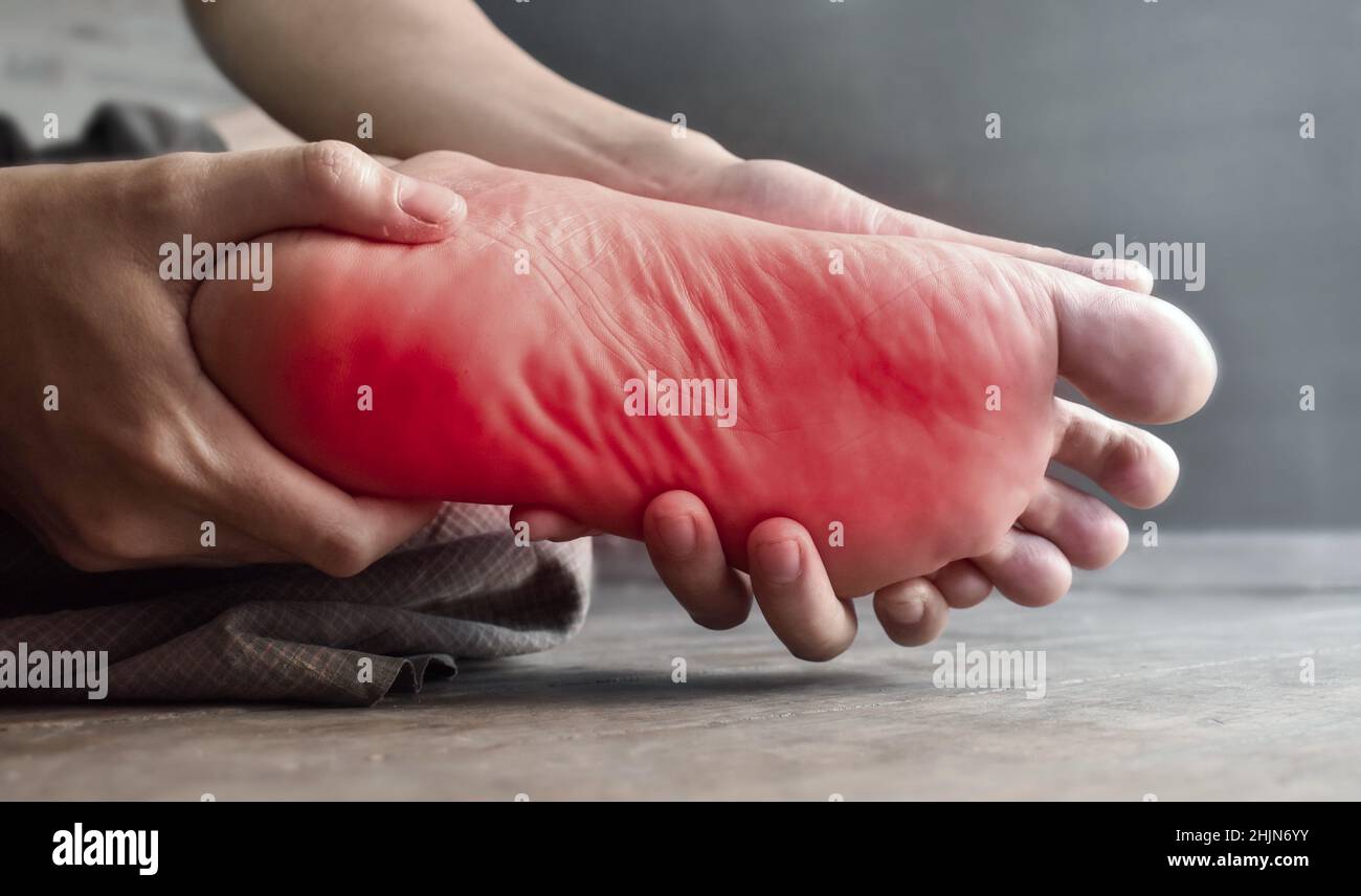 Sensation de picotement et de brûlure au pied du jeune homme asiatique avec diabète.Douleur au