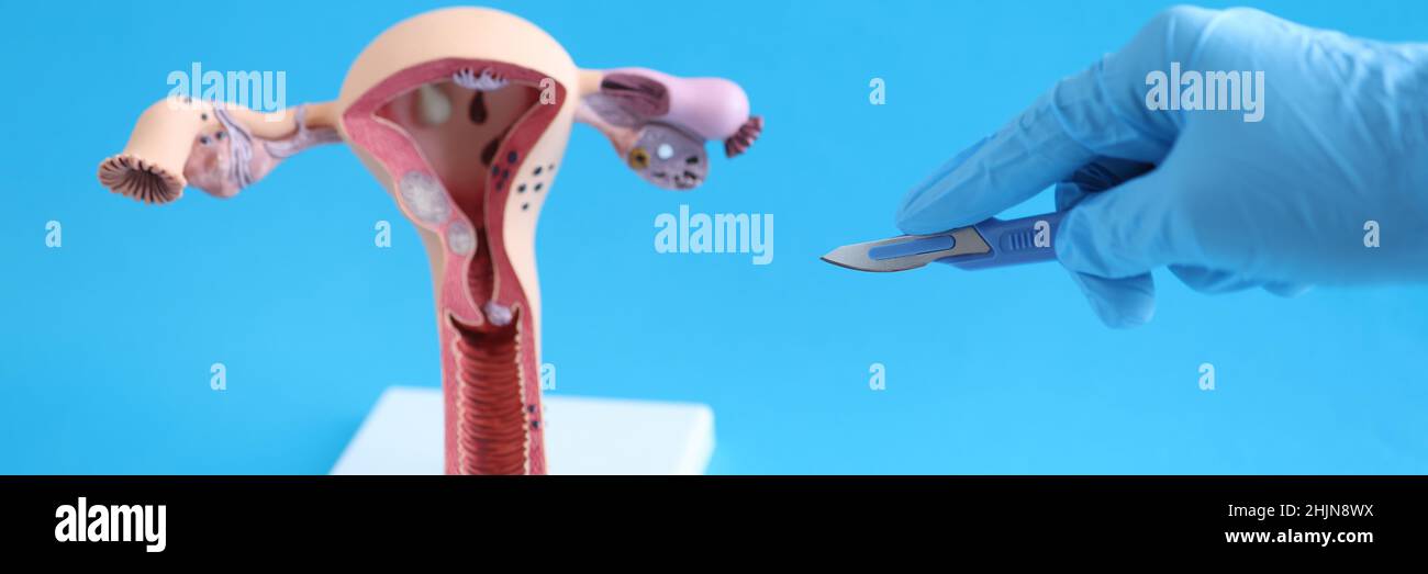 La main gantée du médecin étire le scalpel au système reproducteur féminin Banque D'Images