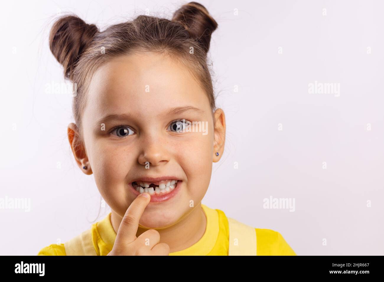 Portrait de jeune fille visage avec la bouche ouverte pointant sur la dent de lait avant manquante avec le doigt regardant l'appareil photo sur fond blanc.Premières dents Banque D'Images