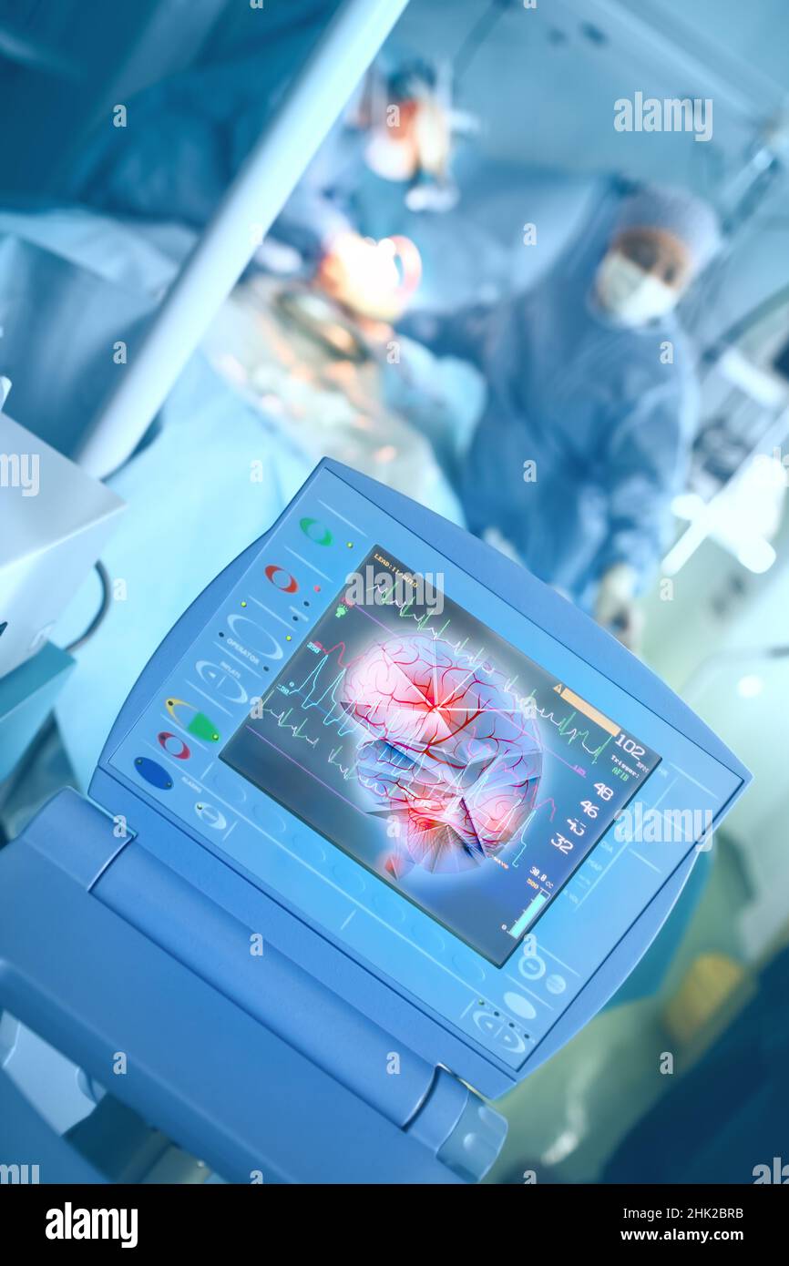 Surveillance moderne de l'aide à la vie pendant une intervention chirurgicale d'urgence avec contrôle de l'ECG et projection cérébrale sur l'écran. Banque D'Images