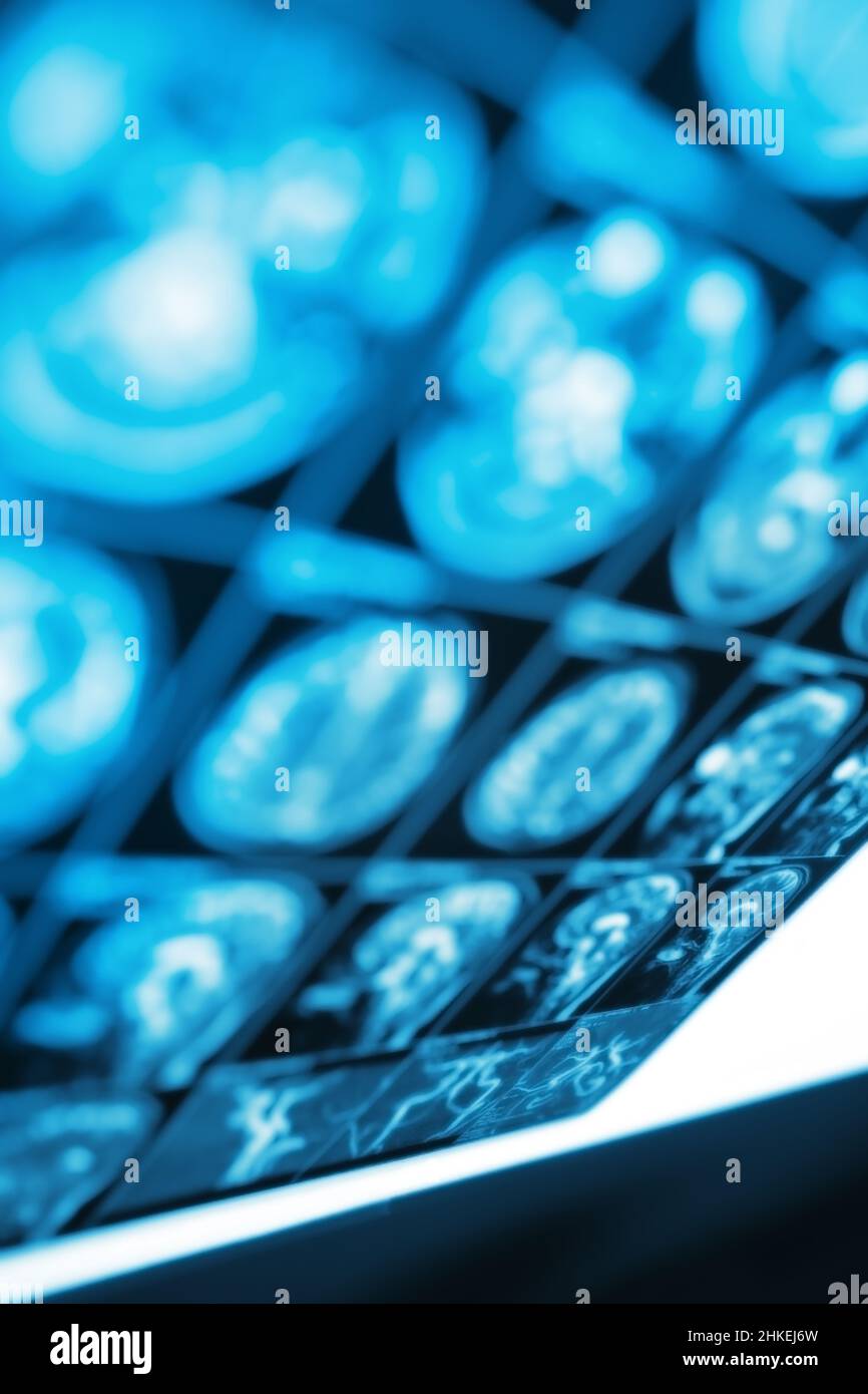 Film IRM sur le nématoscope, arrière-plan non focalisé. Banque D'Images
