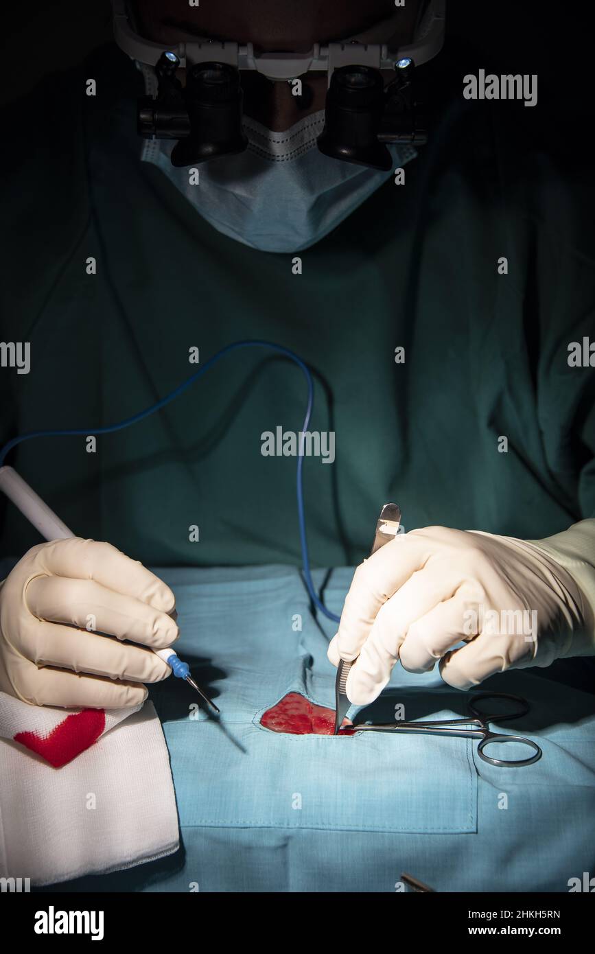 réalisation d'une microchirurgie à une seule streptocoque par une femme traumatitologue-chirurgien. Banque D'Images réalisation d'une microchirurgie à une seule streptocoque par une femme traumatitologue-chirurgien. Banque D'Images