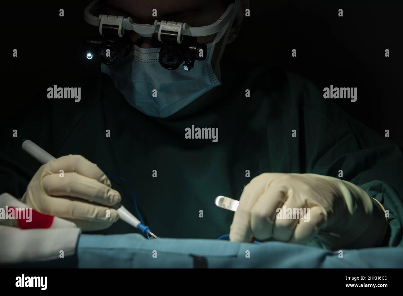 réalisation d'une microchirurgie à une seule streptocoque par une femme traumatitologue-chirurgien. Banque D'Images réalisation d'une microchirurgie à une seule streptocoque par une femme traumatitologue-chirurgien. Banque D'Images