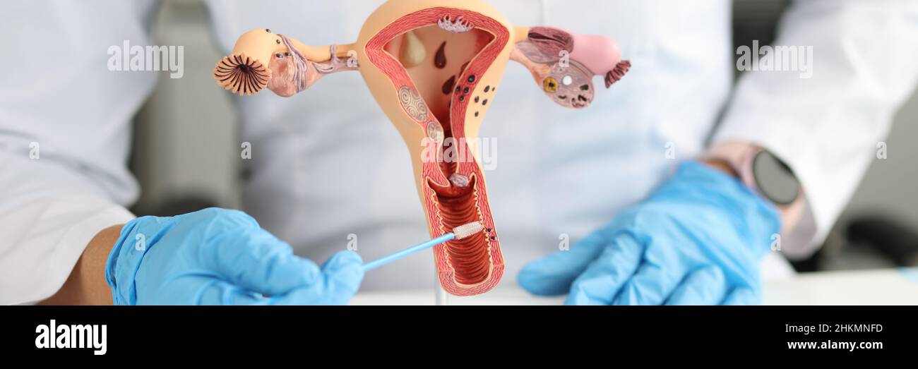 Le gynécologue détient des cytobrosses urogénitales et un modèle de système reproducteur féminin Banque D'Images
