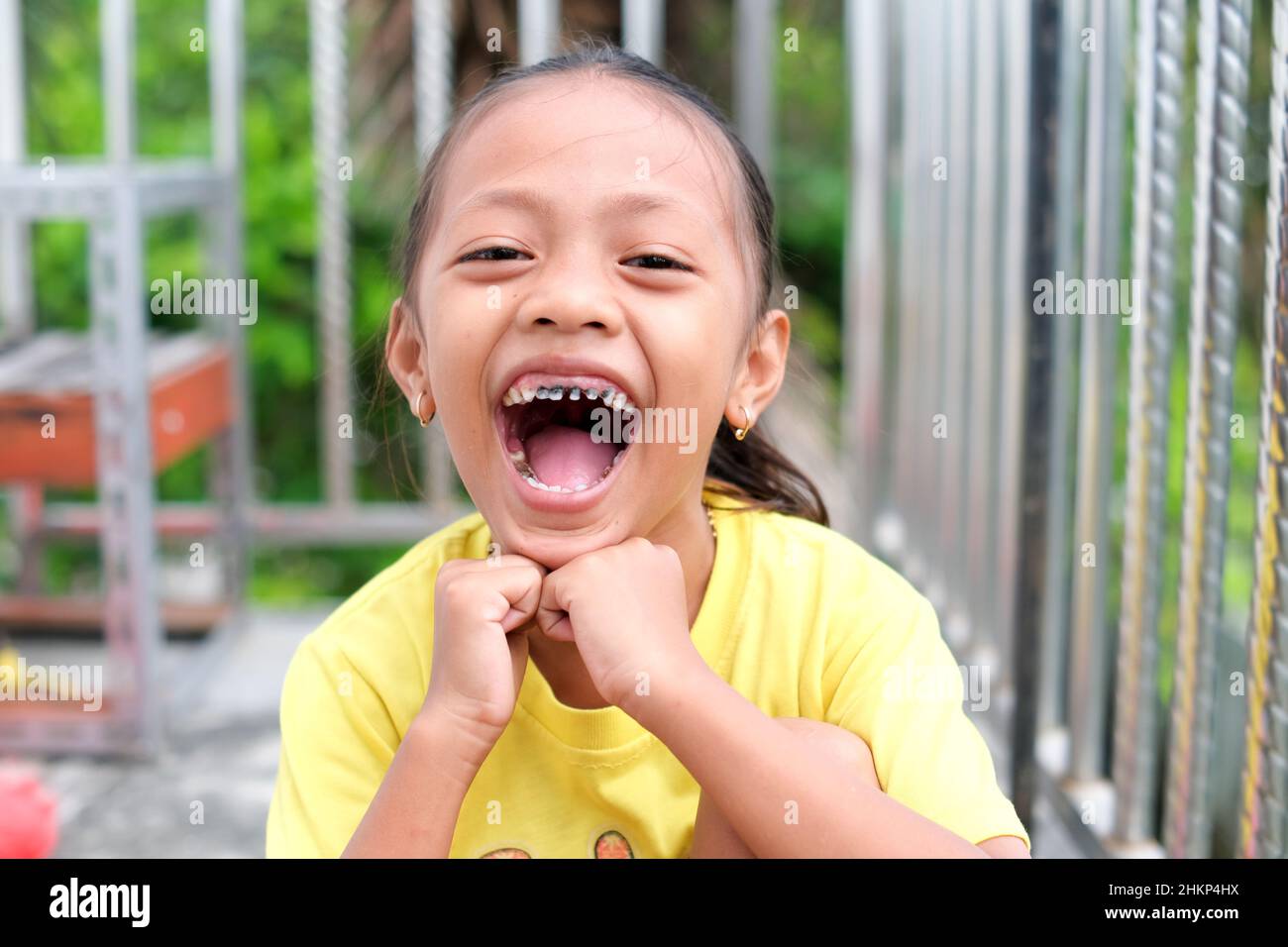 Lampung, Indonésie, février 05 2022- expression d'une petite fille bouche large ouverte avec dents cassées sur la terrasse de la maison. Mise au point sélective. Banque D'Images
