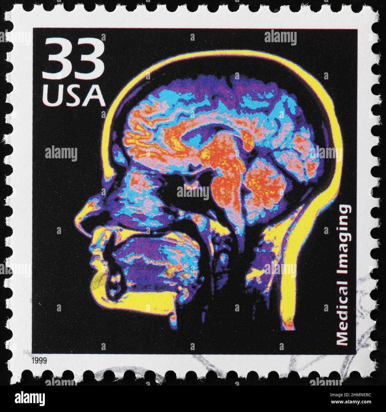 Dispositifs médicaux pour scanner le corps humain sur le timbre américain Banque D'Images