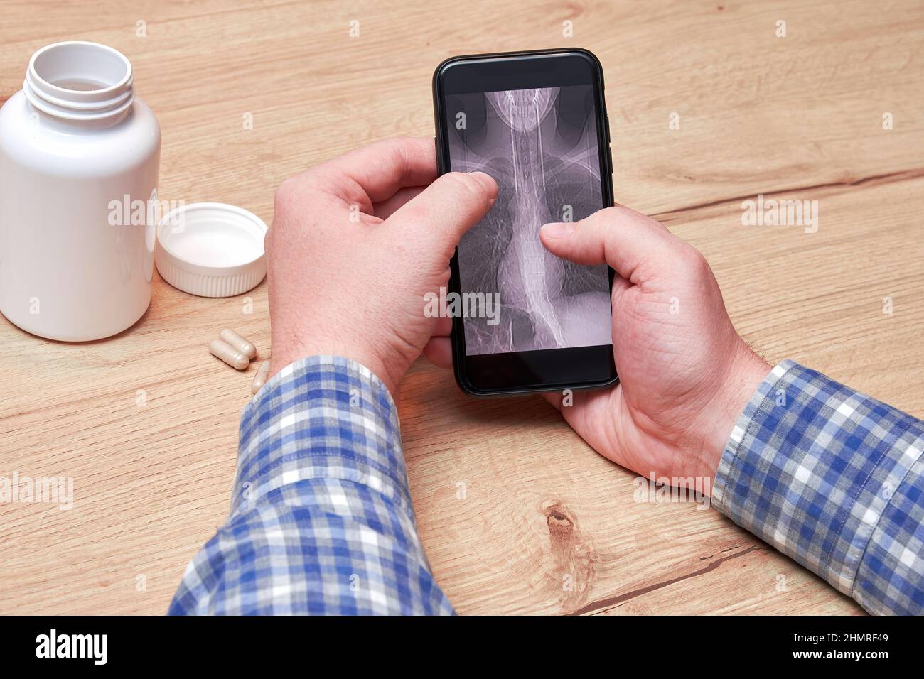 Un vieil homme malade qui vérifie une tomodensitométrie de ses poumons sur l'écran du téléphone cellulaire. Diagnostic de pneumonie et de maladie. Pilules et flacons médicaux Banque D'Images