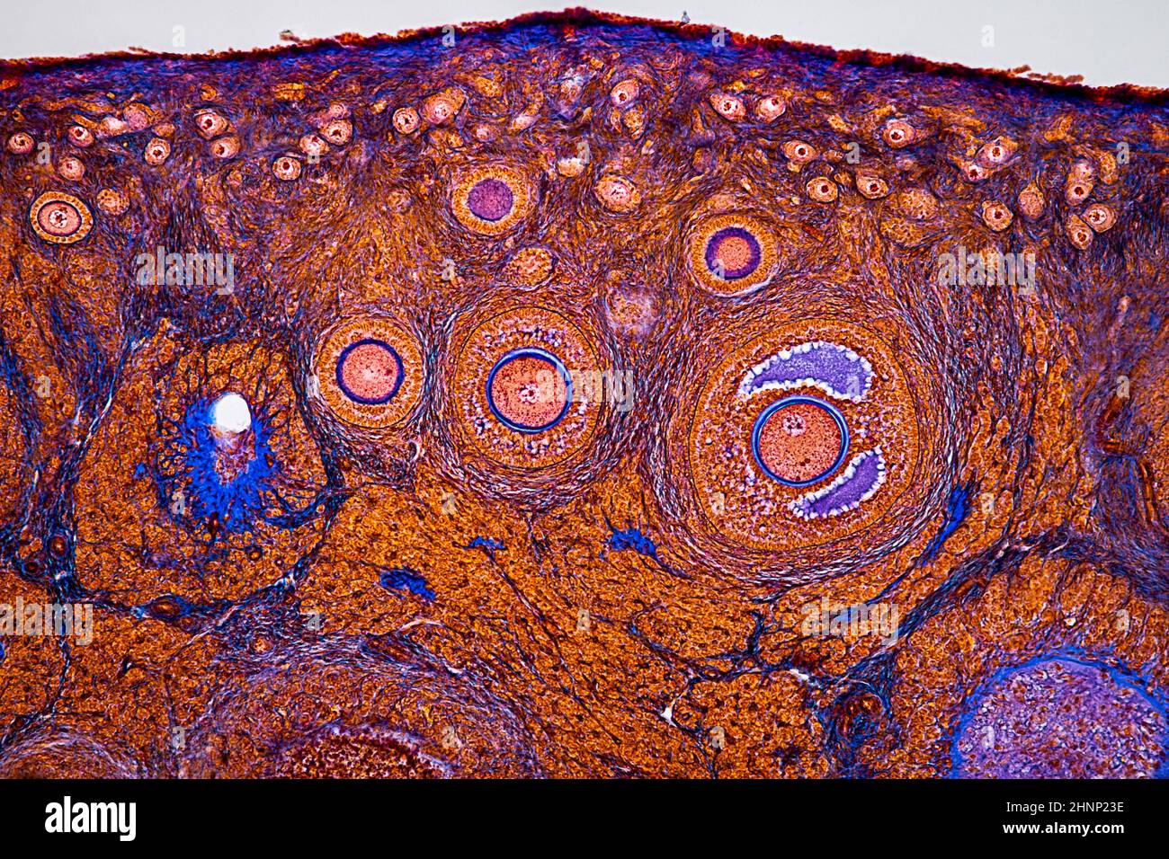 image histologique d'un ovaire montrant des follicules primaires, secondaires et terciaires (grossissement de 100x) Banque D'Images