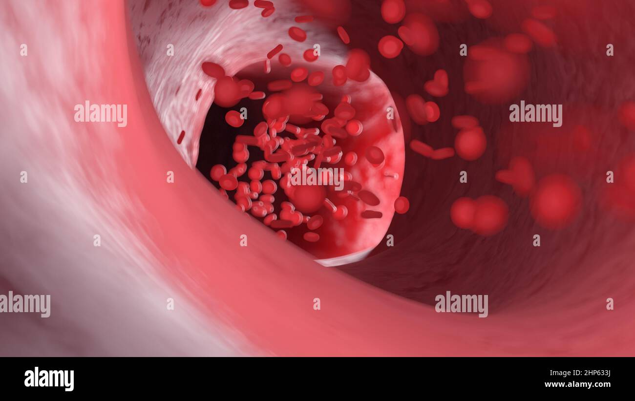 Globules rouges traversant une artère, illustration. Banque D'Images