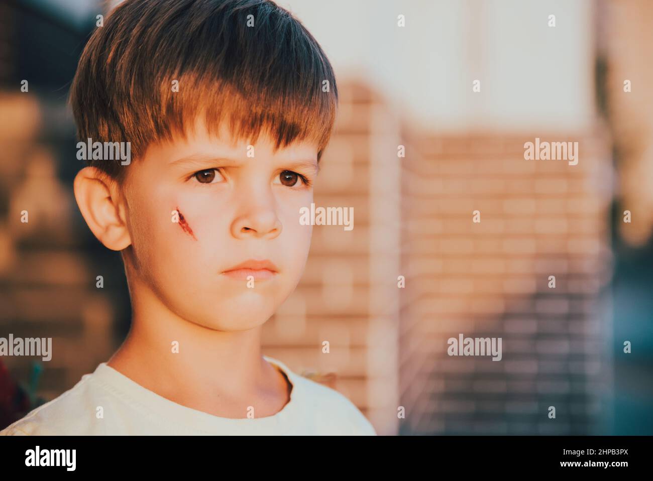 Portrait d'un bel enfant avec une cicatrice sur son visage Photo Stock — free download