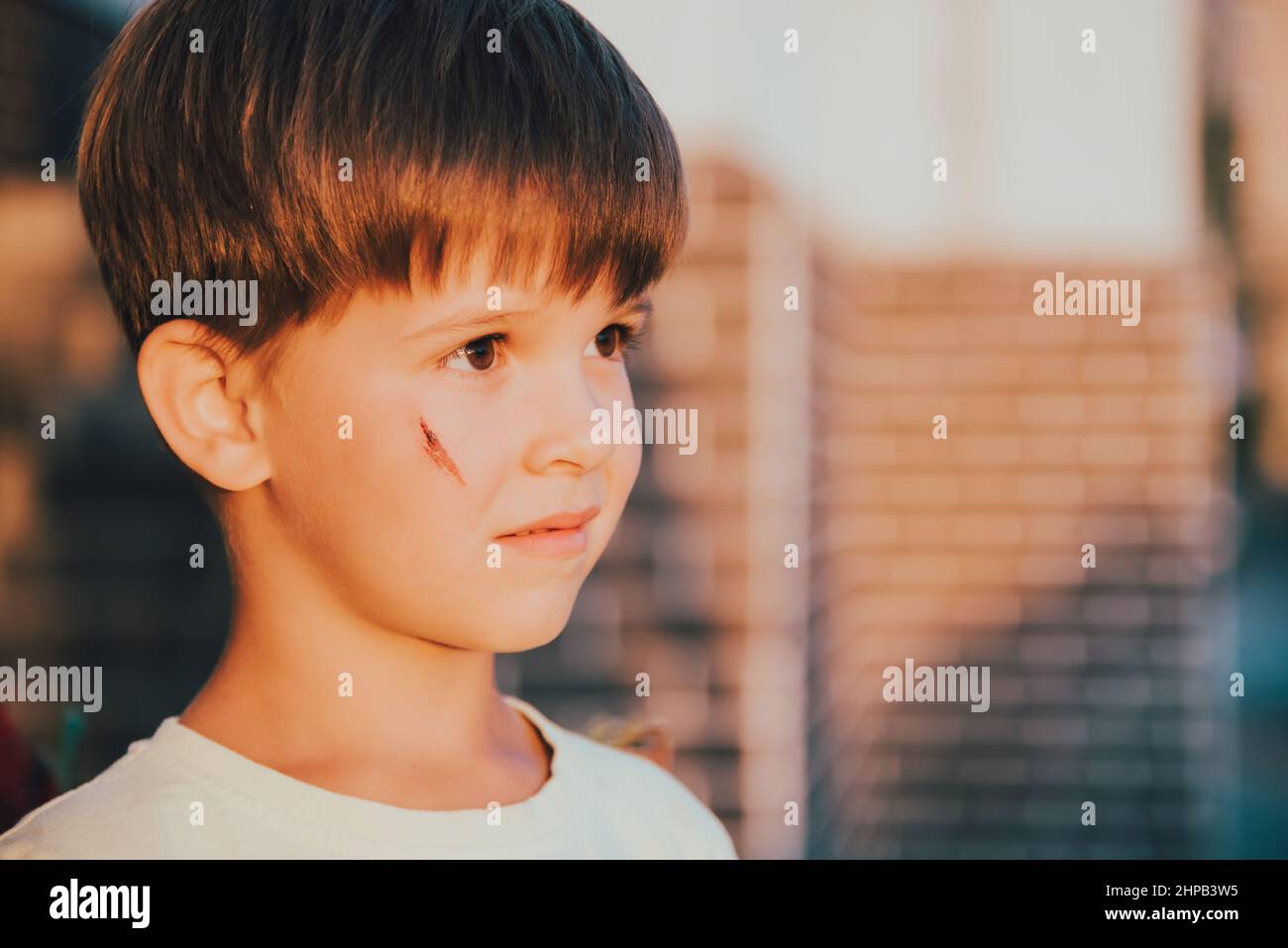 Portrait d'un bel enfant avec une cicatrice sur son visage Photo Stock — free download