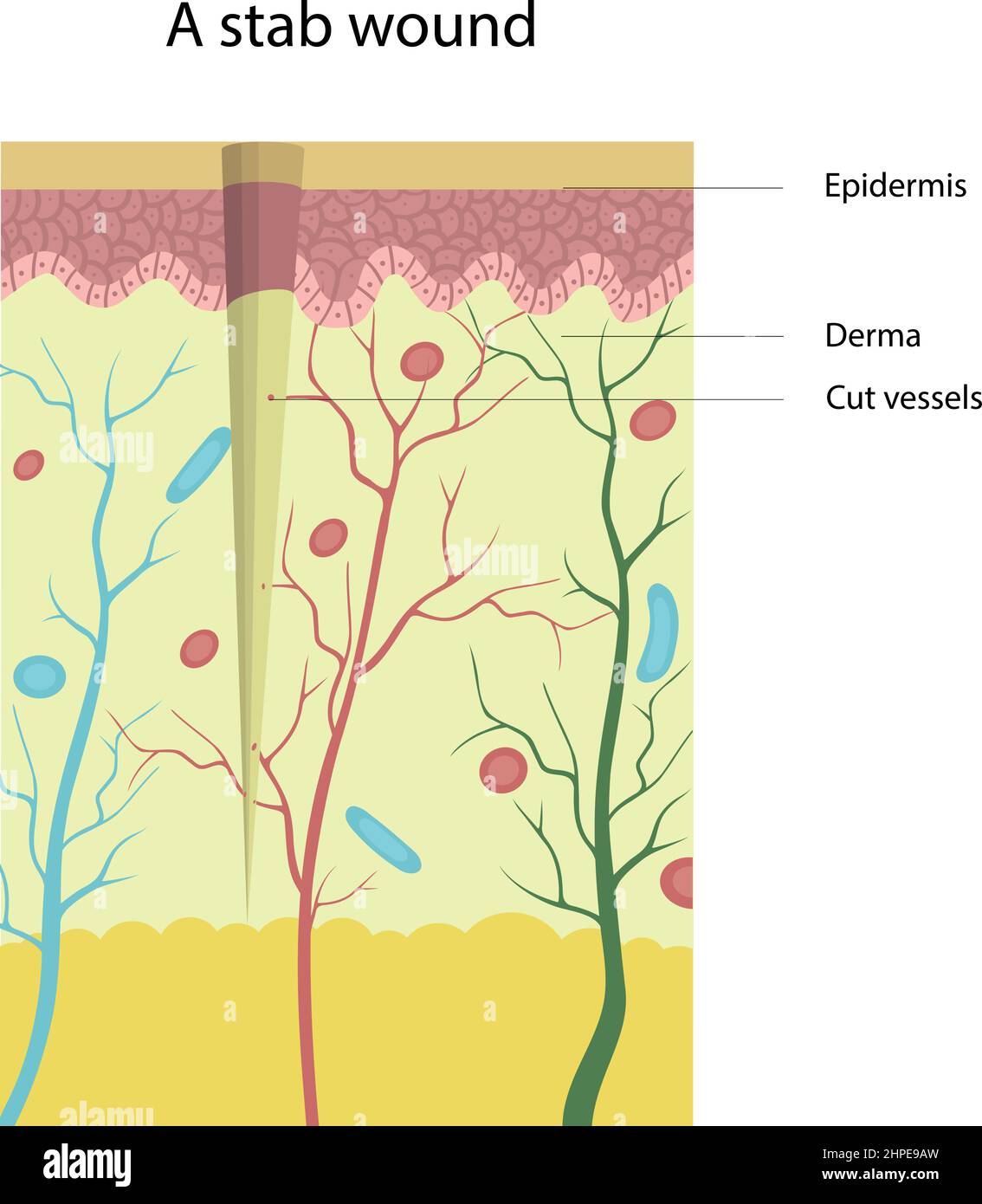 Illustration vectorielle de la structure d'une plaie à stab. Couper les vaisseaux. Blessures cutanées. Illustration de Vecteur