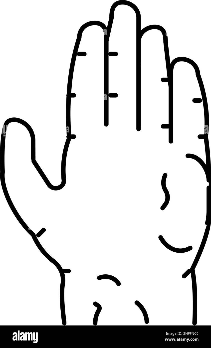 illustration du vecteur de l'icône de la ligne de la maladie de la peau de la sclérodermie Illustration de Vecteur