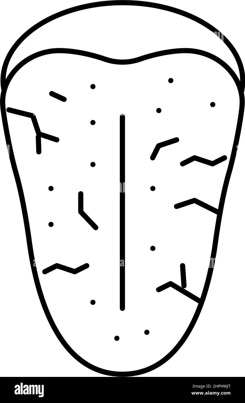 illustration du vecteur de la ligne du syndrome de sjogrens Illustration de Vecteur