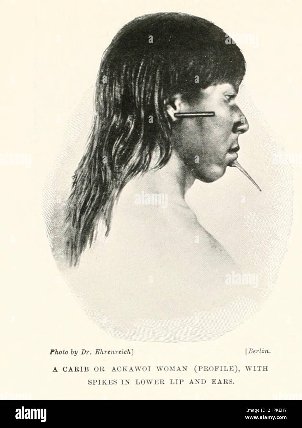 Une femme Carib ou Ackawoi (profil), avec des pointes dans la lèvre inférieure et les oreilles la Kalina, également connue sous le nom de Caribs, Caribs continentaux et plusieurs autres noms, sont un peuple indigène des zones côtières du nord de l'Amérique du Sud. Extrait du livre The Living races of Humen; Volume 2 de Henry Neville Hutchinson, publié à Londres en 1901 par Hutchinson & co Banque D'Images