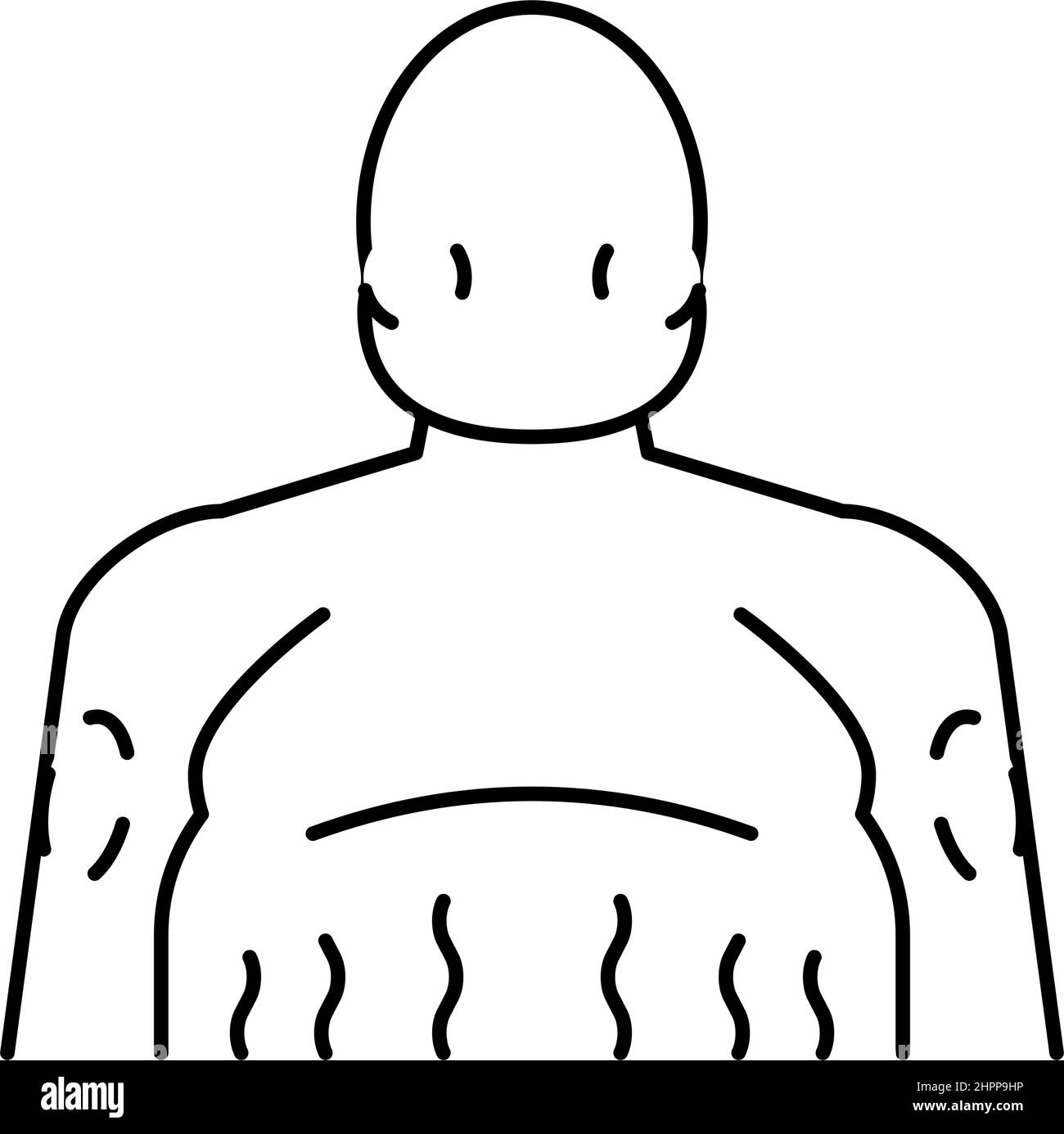 illustration vectorielle de la ligne d'endocrinologie de la maladie de cushing Illustration de Vecteur