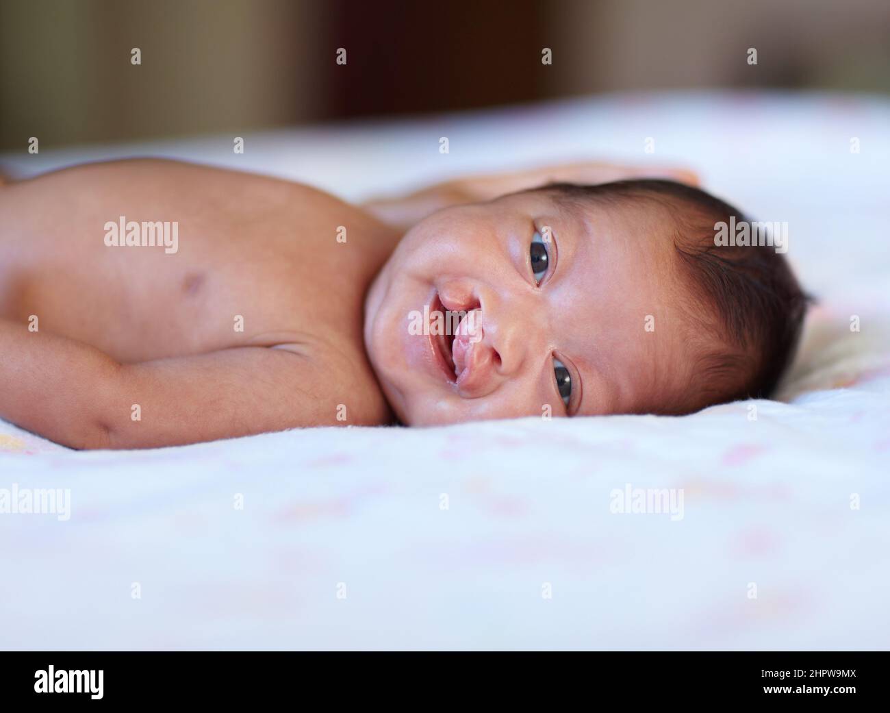 Elle ne laisse pas son défaut de naissance la réduire. Portrait d'une petite fille avec une fente palatine sur un lit. Banque D'Images