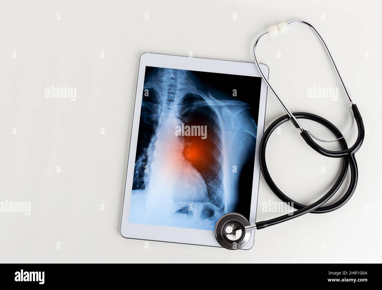 Un comprimé avec une radiographie d'un poumon et un stéthoscope sur une table dans un hôpital Banque D'Images