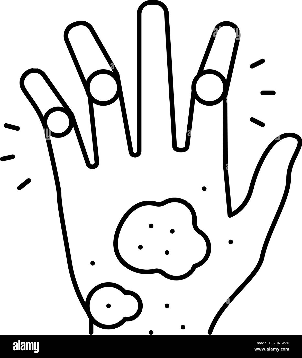 arthrite psoriasique ligne de problème de santé de la peau icône illustration du vecteur Illustration de Vecteur