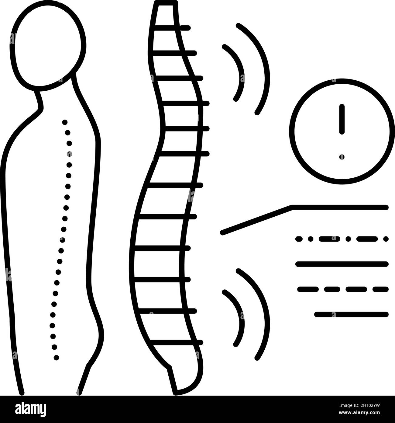 illustration du vecteur de la ligne de problème de santé des spondyloarthropathies Illustration de Vecteur
