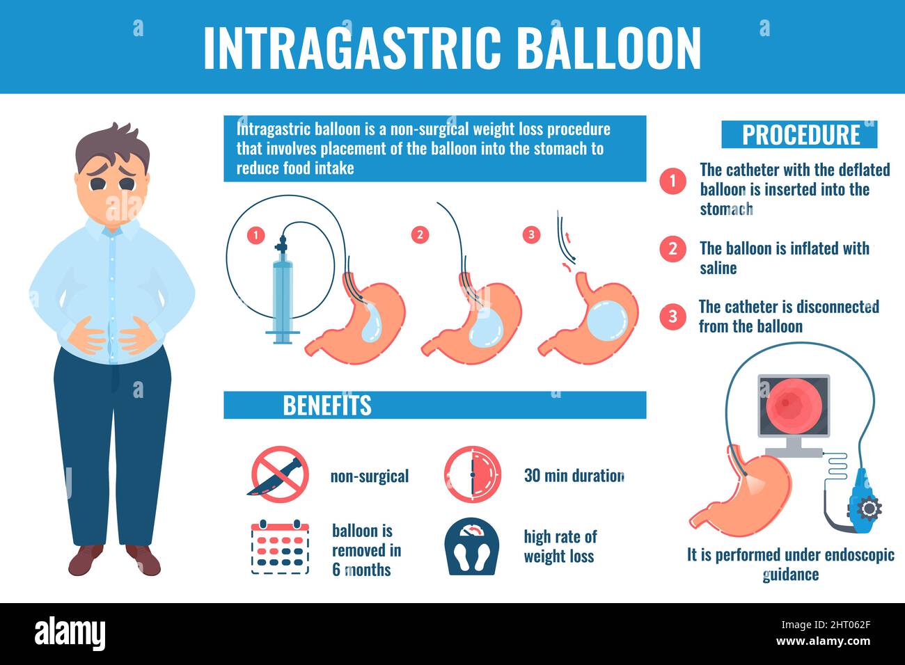 Ballon gastrique, illustration conceptuelle Banque D'Images