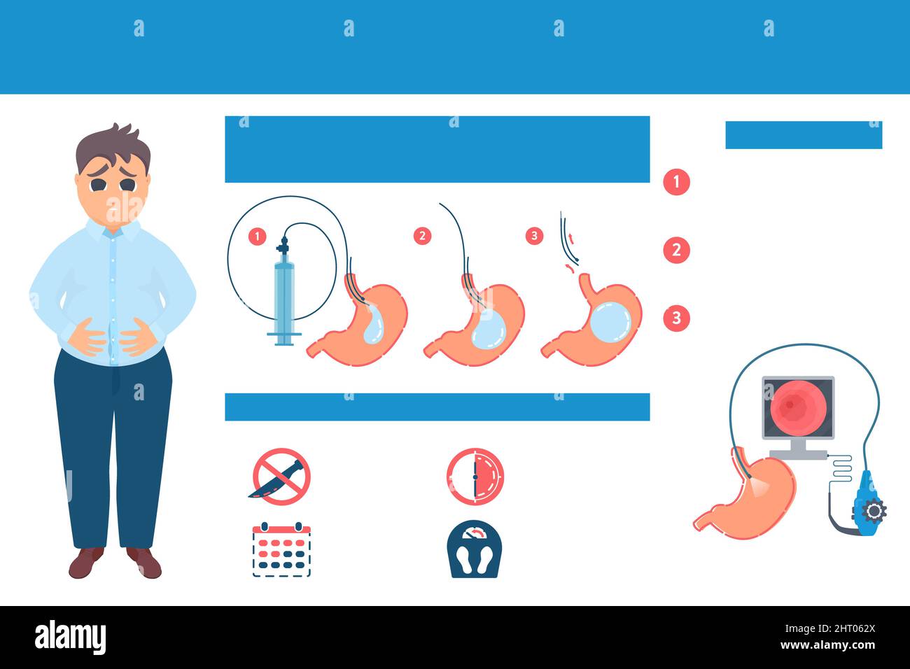 Ballon gastrique, illustration conceptuelle Banque D'Images