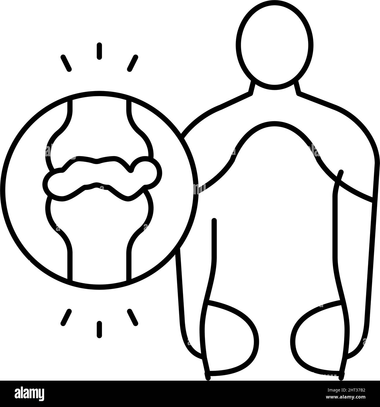 illustration du vecteur de la ligne polymyalgie rhumatismale Illustration de Vecteur