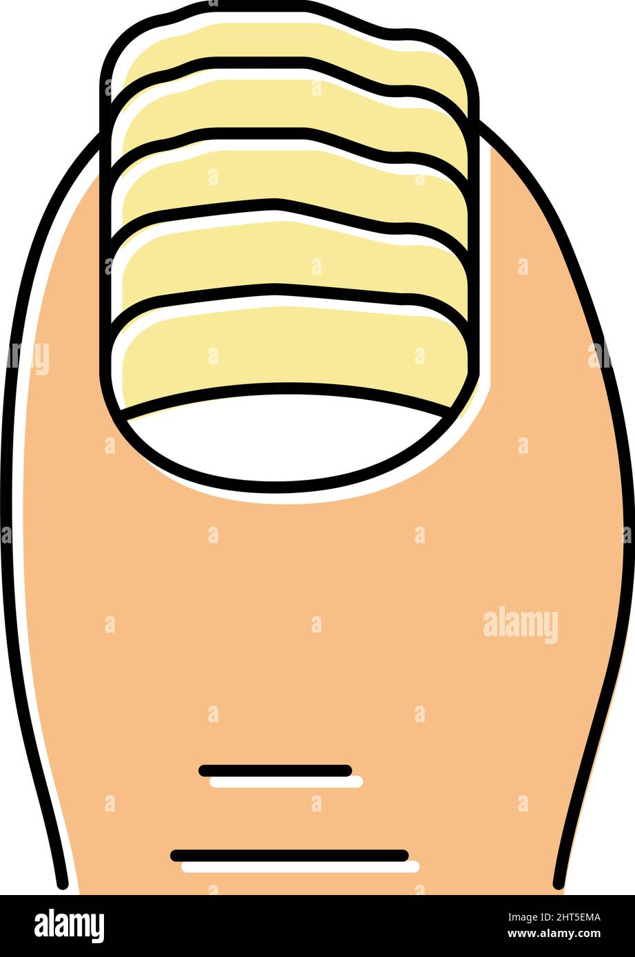 illustration du vecteur de couleur d'icône de champignon d'ongle Illustration de Vecteur