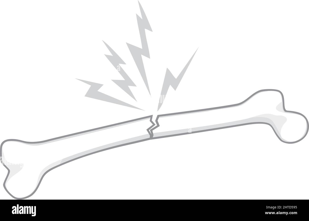 Illustration d'un vecteur osseux humain cassé Illustration de Vecteur