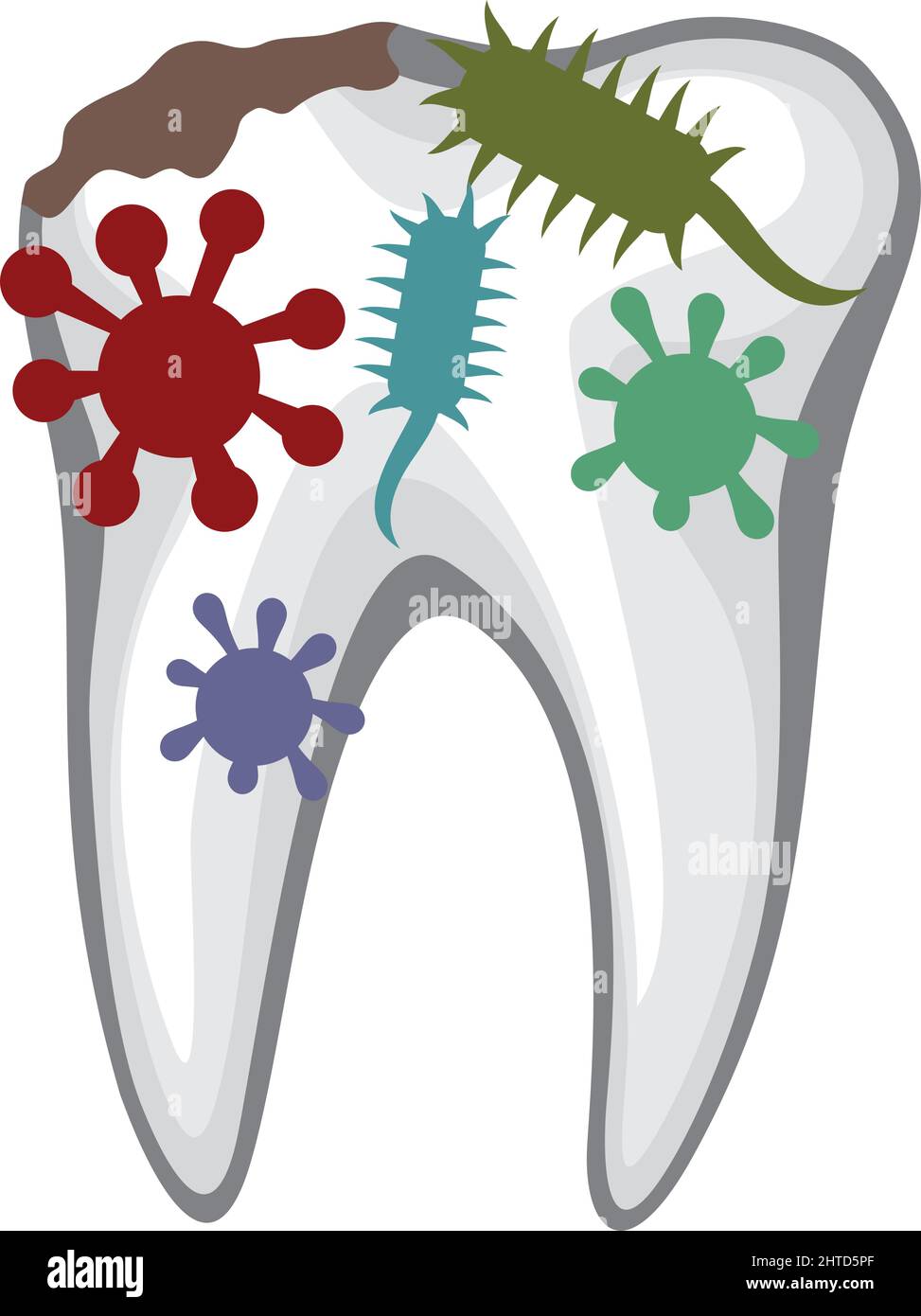 Dent humaine avec illustration de vecteurs de caries et de bactéries Illustration de Vecteur