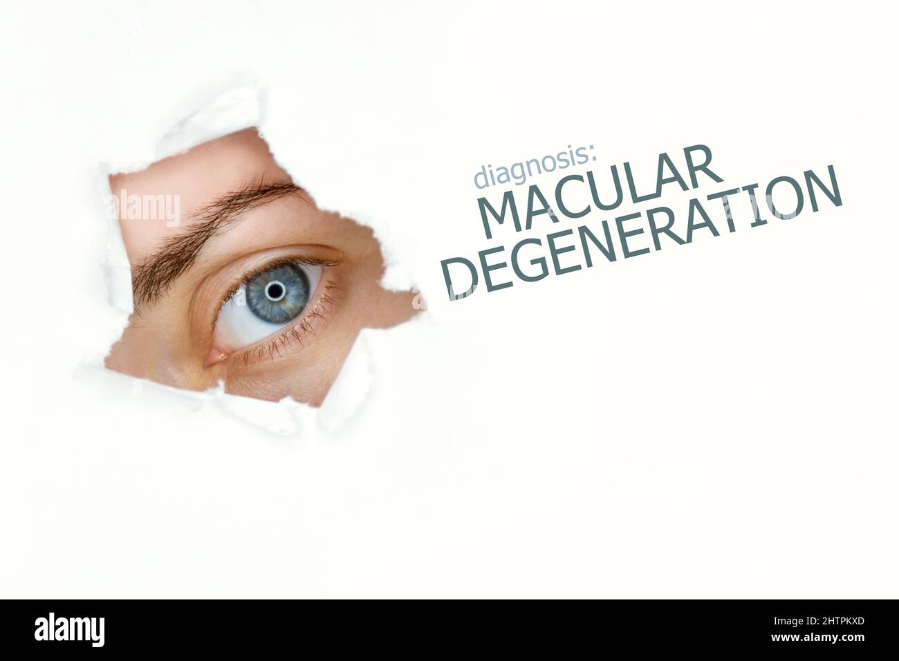 Affiche de la maladie de dégénérescence maculaire avec carte de test oculaire et œil bleu.isolé sur blanc Banque D'Images