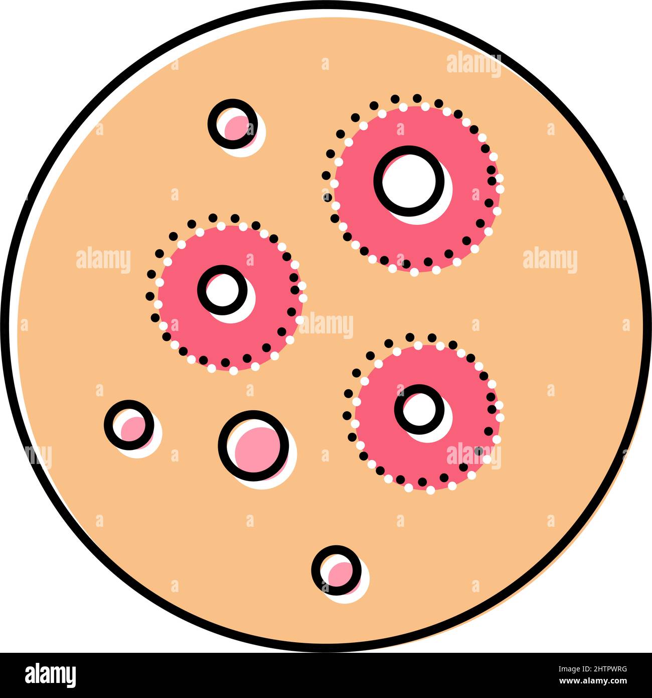 illustration du vecteur de couleur de la maladie de peau d'acné Illustration de Vecteur