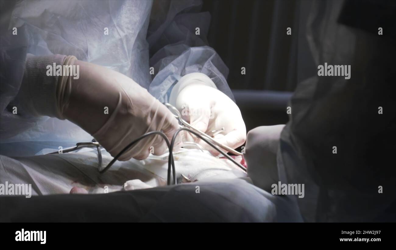 Antécédents médicaux avec détails de la chirurgie. Opération de chirurgie de procédé effectuée par le groupe de chirurgiens professionnels en salle blanche avec des équipements spéciaux Banque D'Images