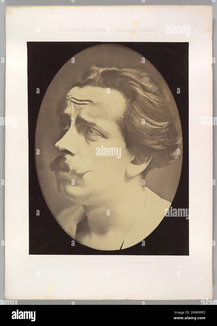 Art inspiré par la figure 25 : pas une expression de la douleur, 1854–56, imprimé en 1862, imprimé en argent d'albumine de négatif de verre, image (ovale) : 28,4 × 20,4 cm (11 3/16 × 8 1/16 po), photographies, Guillaume-Benjamin-Amand Duchenne de Boulogne (français, 1806–1875), Adrien Tournachon (français, 1825–, œuvres classiques modernisées par Artotop avec une touche de modernité. Formes, couleur et valeur, impact visuel accrocheur sur l'art émotions par la liberté d'œuvres d'art d'une manière contemporaine. Un message intemporel qui cherche une nouvelle direction créative. Artistes qui se tournent vers le support numérique et créent le NFT Artotop Banque D'Images