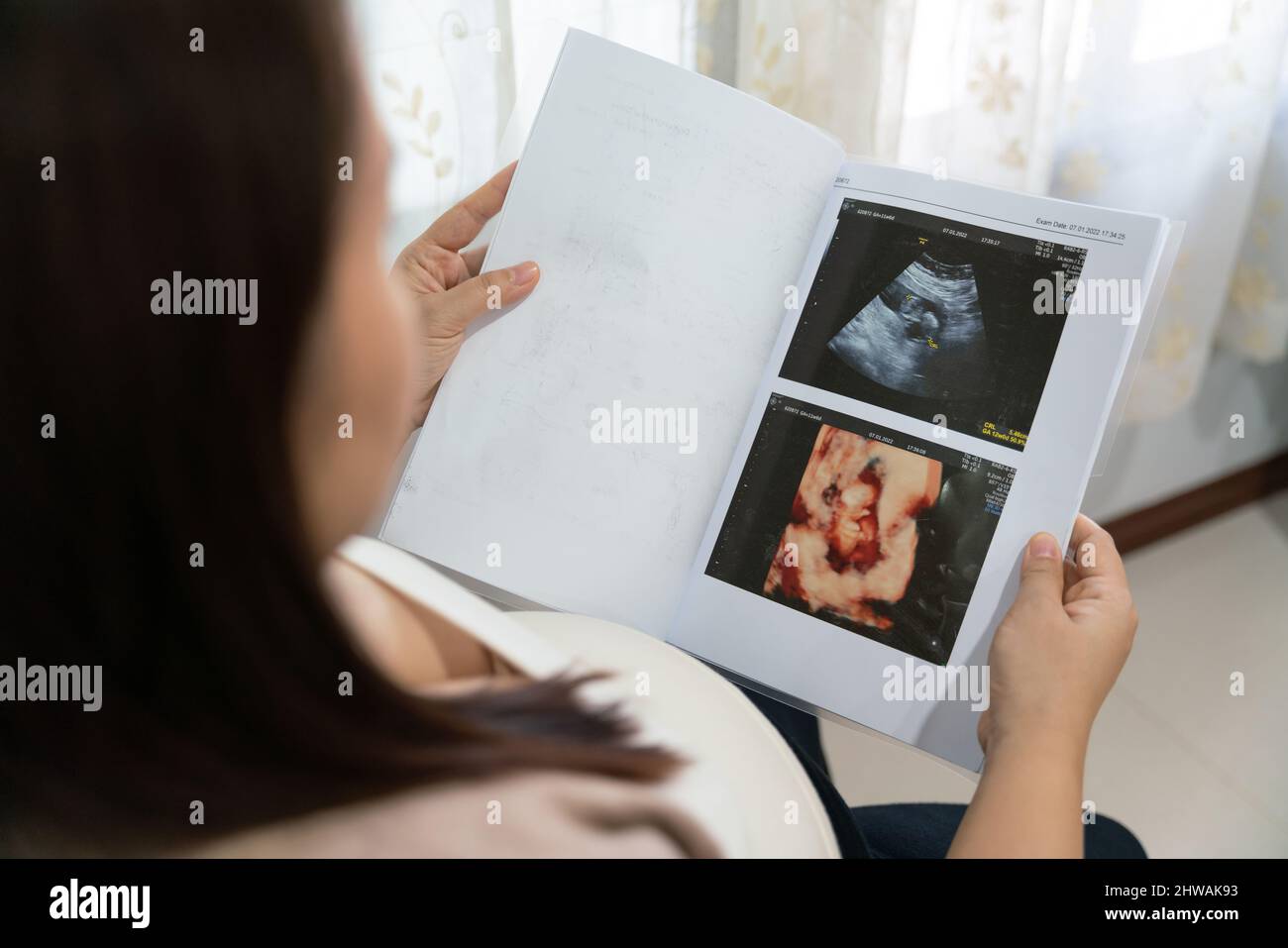 Asiatique jeune femme enceinte regardant mignon enceinte ventre et rayons X échographie scan de bébé. Concept de maternité troisième trimestre, rayons X enceinte. Banque D'Images