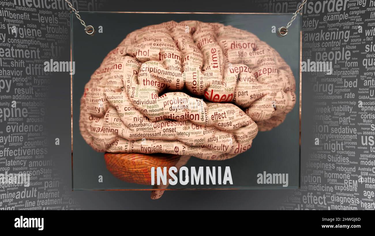 Anatomie de l'insomnie - ses causes et effets projetés sur un cerveau ...