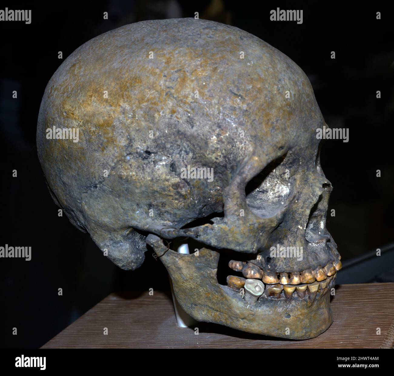 La déformation intentionnelle du crâne a été réalisée dans des cultures anciennes à travers le monde. Il a été fait sur les nourrissons pour des raisons sociales par les cultures anciennes. Banque D'Images