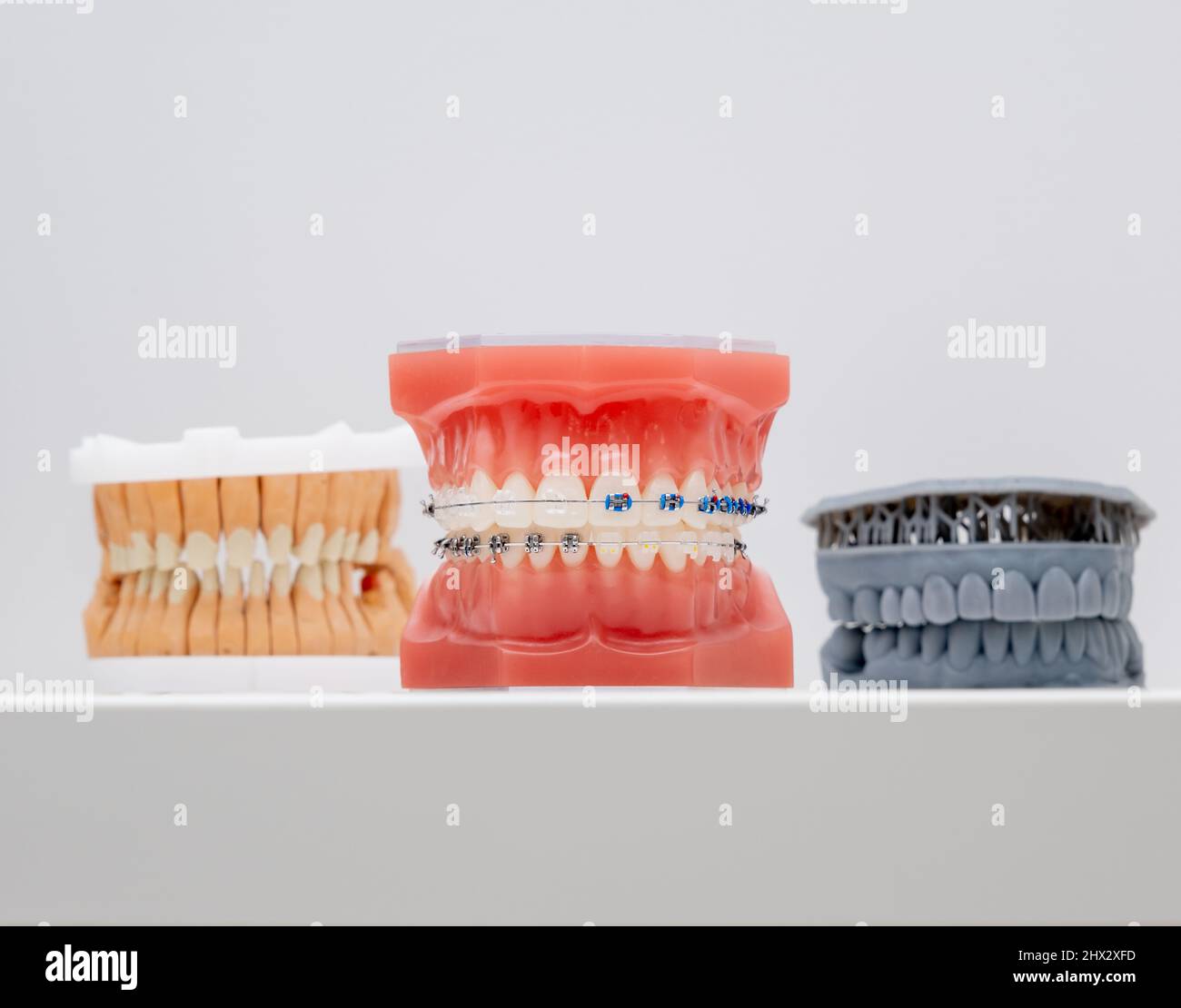 Entretoises en métal et en céramique sur les dents sur une mâchoire artificielle de près. Accolades sur les dents artificielles gros plan, dentisterie dentaire. Modèle de mâchoire pour l'affichage d'un Banque D'Images