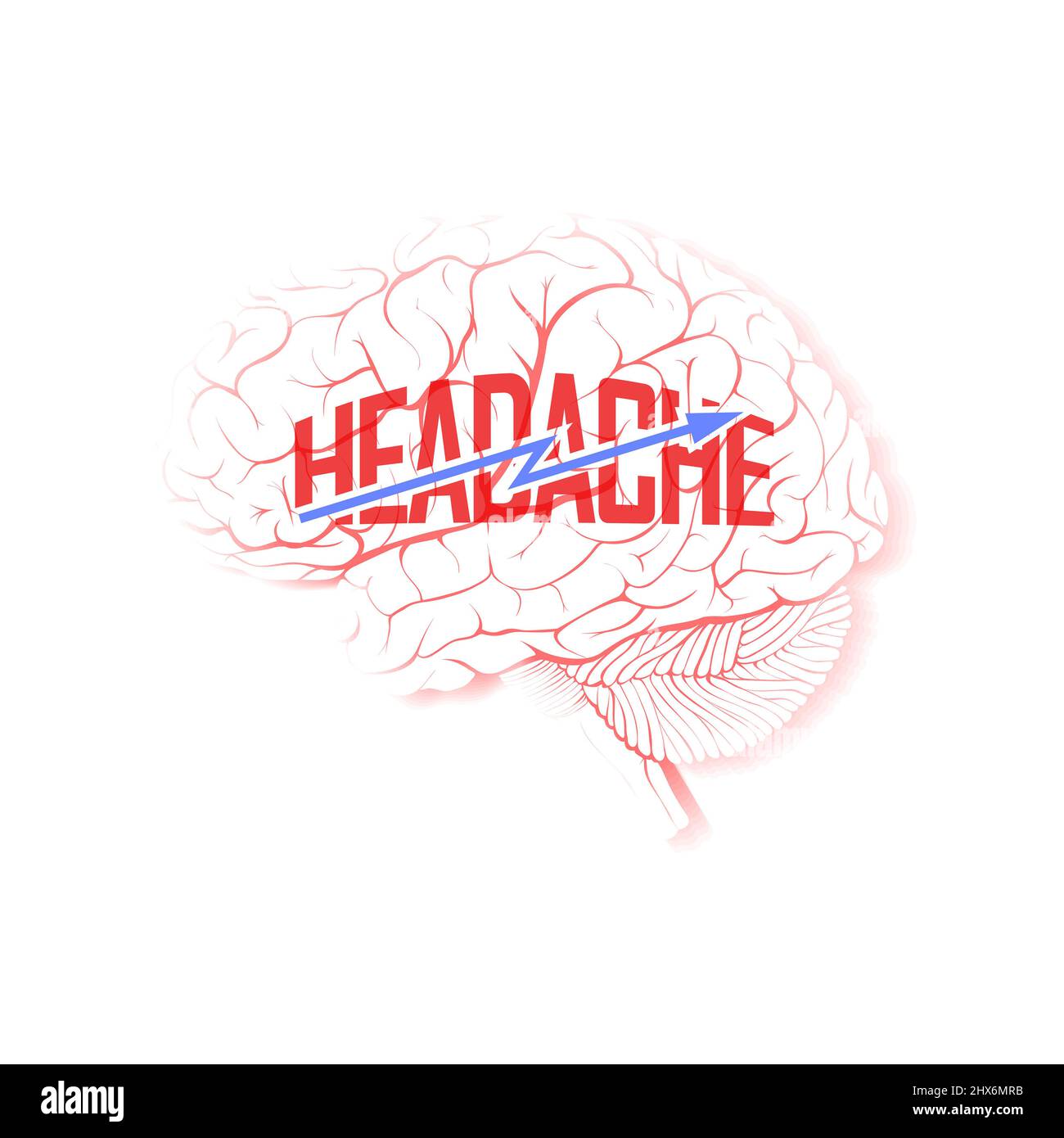 Cerveau avec la foudre et le mot « mal de tête ». Isolé sur fond blanc. Illustration Banque D'Images