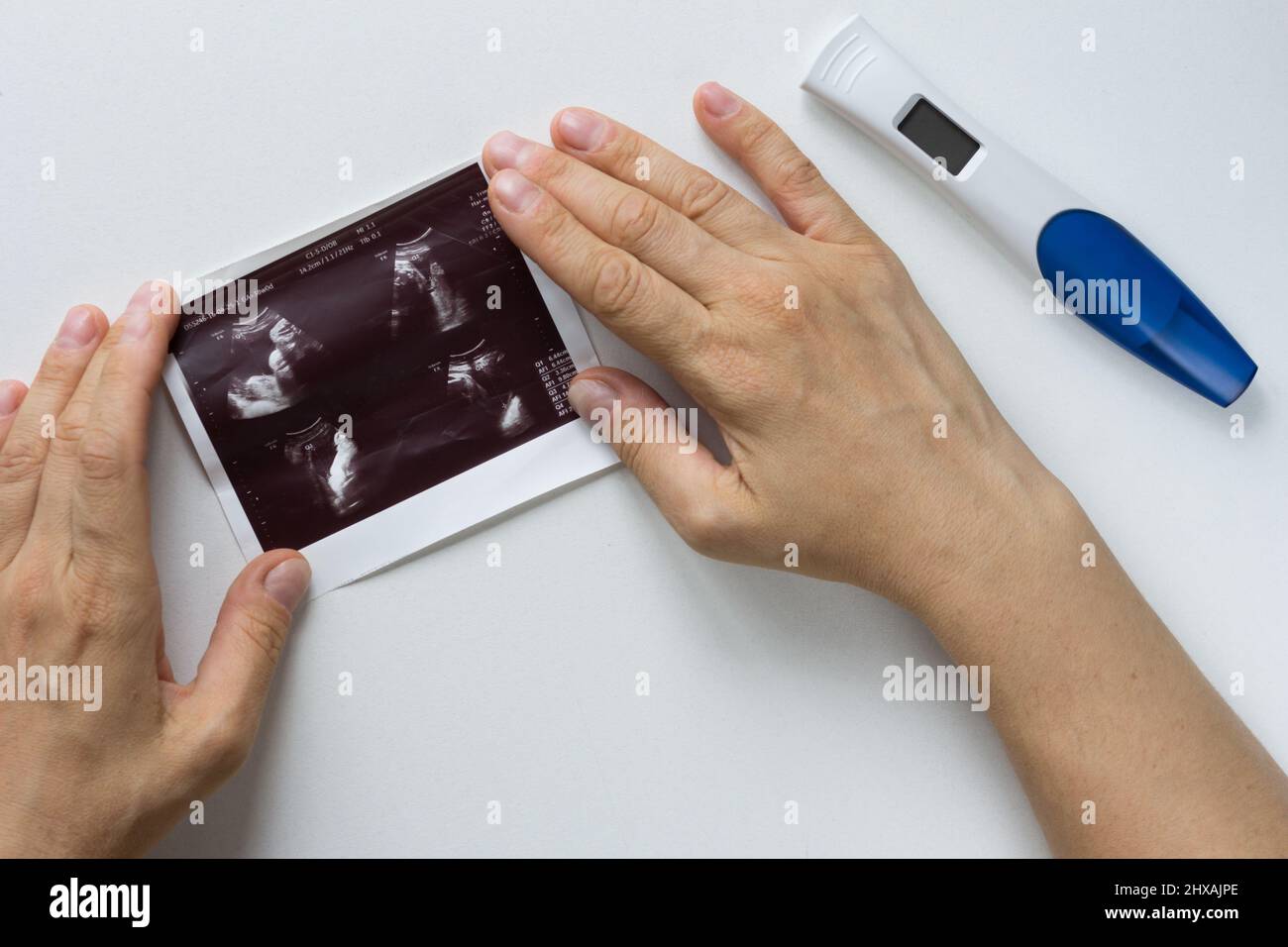 Femme mains tenant une image de l'échographie de l'embryon sur le fond blanc et test de grossesse Banque D'Images