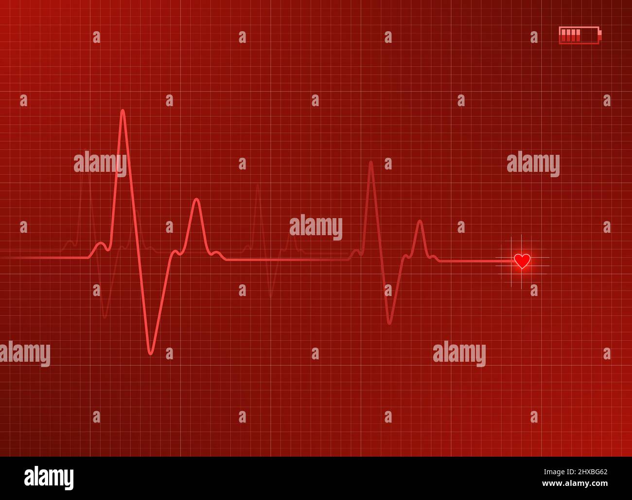 Illustration de l'électrocardiogramme en rouge avec icône de batterie. Illustration de Vecteur