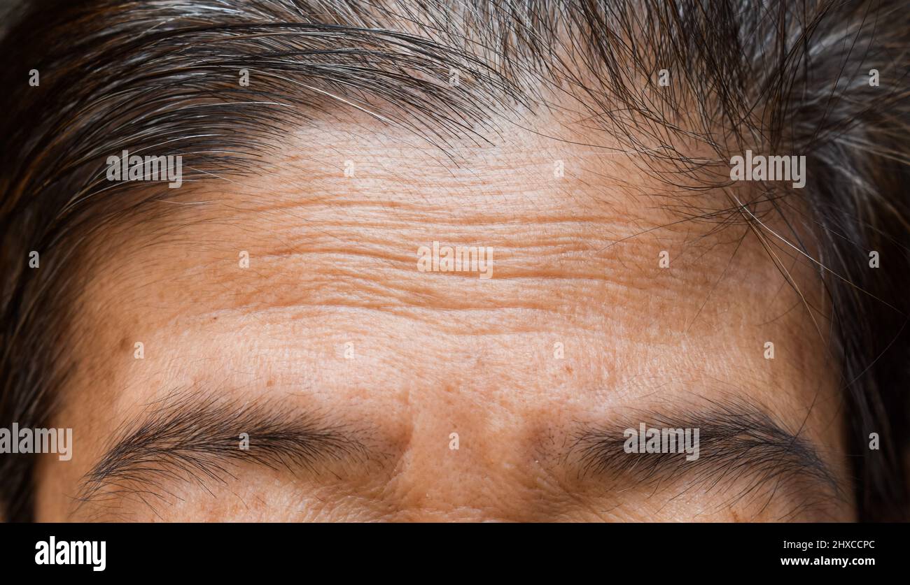 Plis ou rides de la peau sur le front huileux de l'Asie du Sud-est, du Myanmar ou de la femme aînée birmane. Symptôme de vieillissement. Banque D'Images
