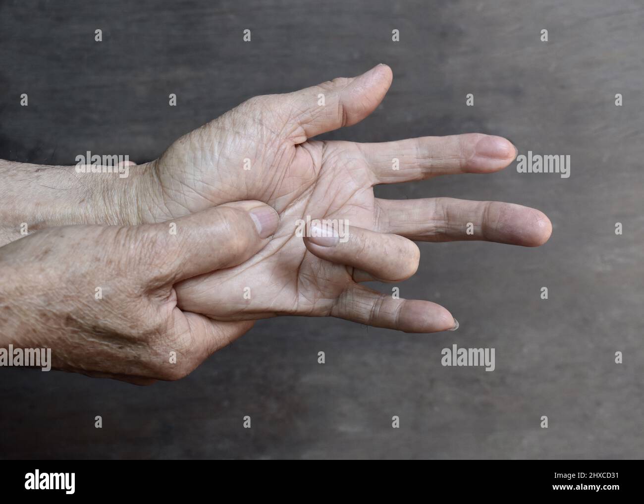 Douleur au tendon fléchisseur chez le vieil homme asiatique. Concept de tendonitis flexor. Blessures aux tendons. Banque D'Images