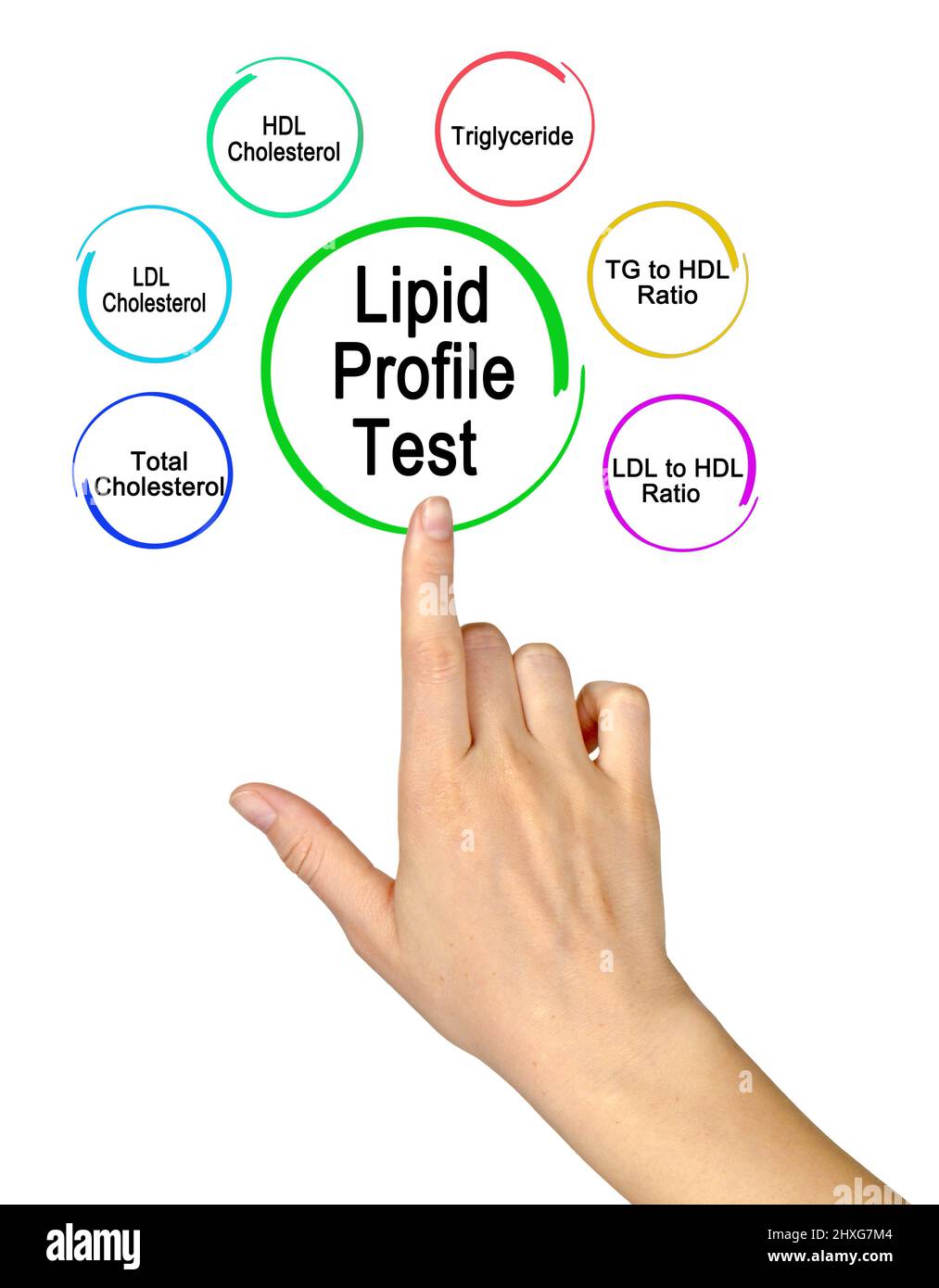Six composants du test de profil lipidique Banque D'Images