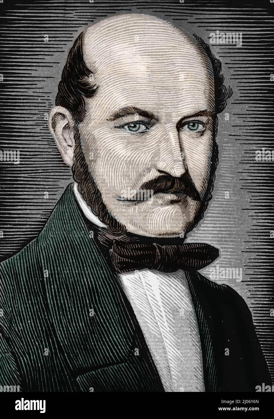 Portrait D Ignace Philippe Semmelweis 1818 1865 Medecin Obst tricien Portrait D Ignace Philippe Semmelweis 1818 1865 Medecin Obst tricien