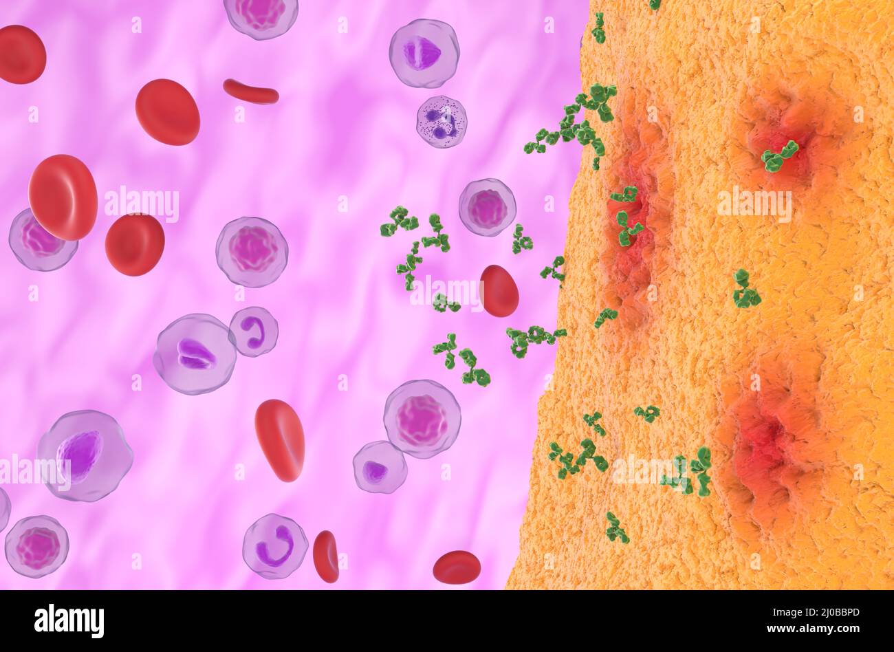 Les anticorps monoclonaux s'approchent de l'articulation inflammatoire dans la polyarthrite rhumatoïde - vue avant 3D illustration Banque D'Images