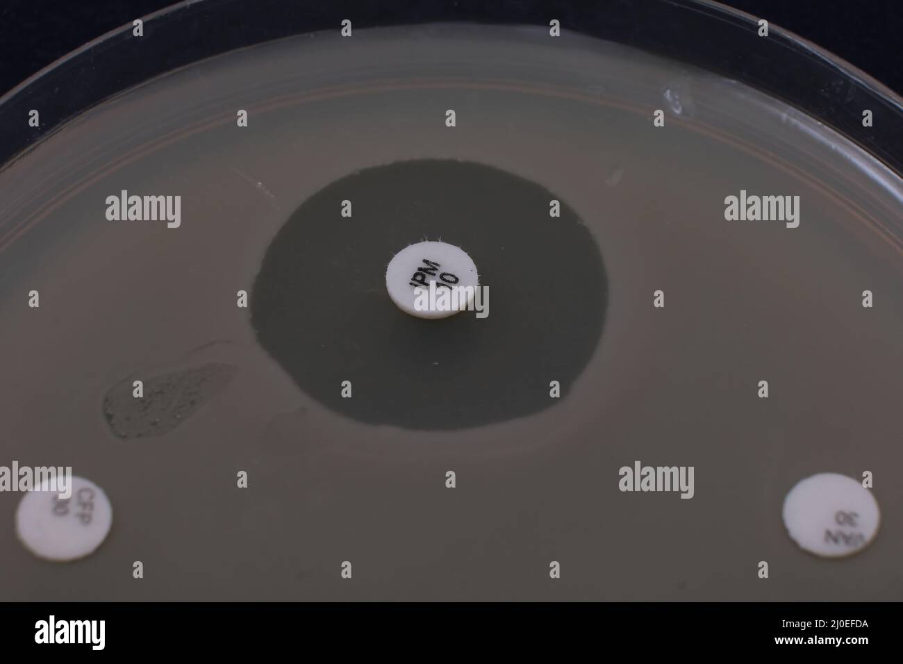 gros plan photo de la zone d'inhibition de la croissance bactérienne autour du disque antibiotique Banque D'Images