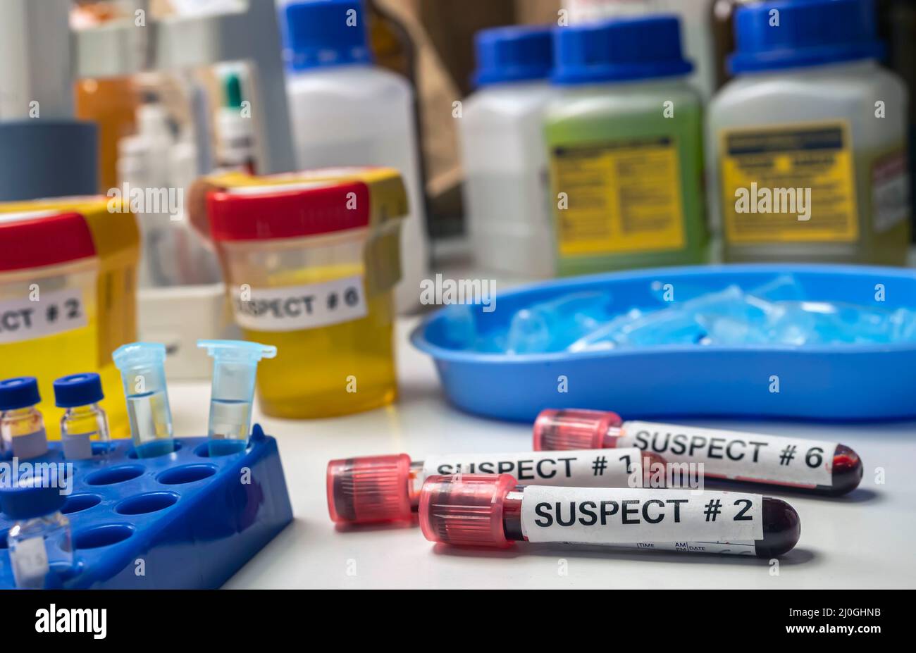 Diverses analyses d'urine, de salive et de sang de suspects d'homicide en laboratoire de crime, image conceptuelle. Banque D'Images