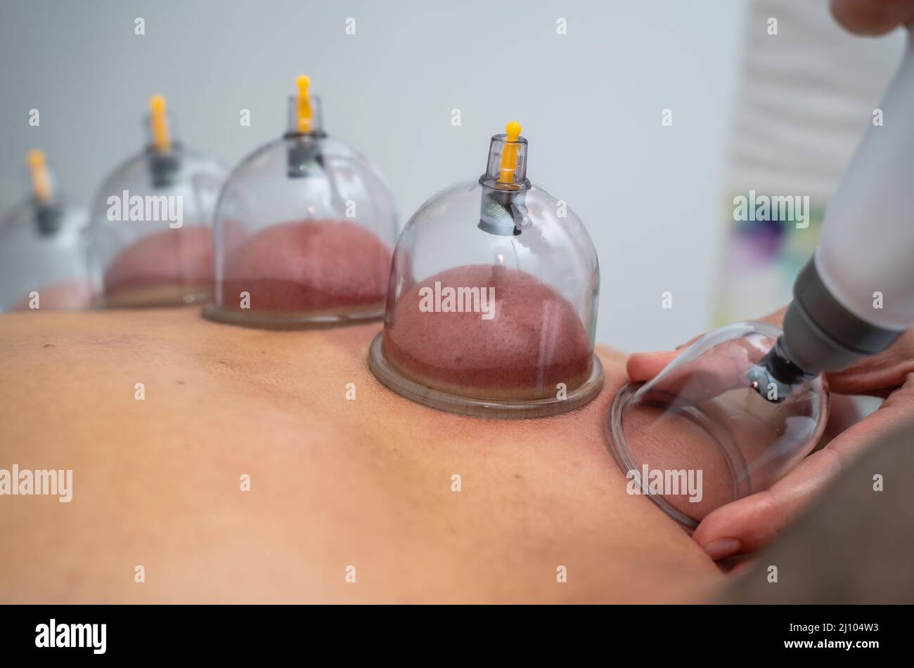 Massage, soin de relaxation Banque D'Images